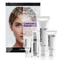 CR resurfacing kit